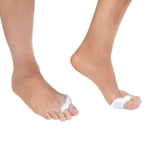 هالوکس والگوس تک‌انگشتی دکاموند